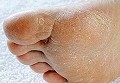 Best Foot Doctor NYC-Dr.Sophia Solomon